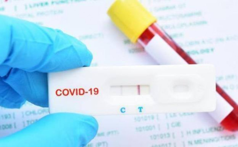 Imagen prueba antigenos COVID 1